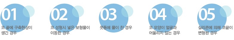 코성형