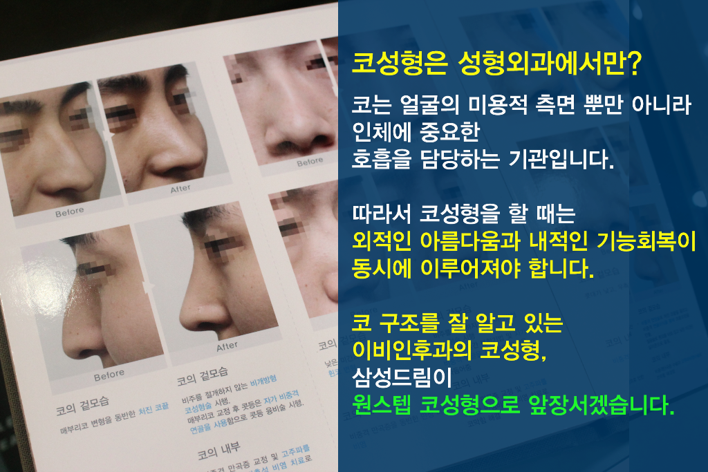 pkMO0d2SUzJ3Fwrn_20160504.png 비중격만곡증코성형