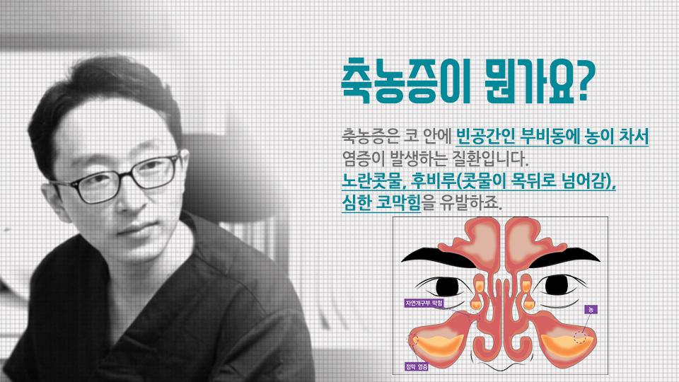 Ac1O3j4vxGLe86ls_20170914.jpg 축농증수술증상