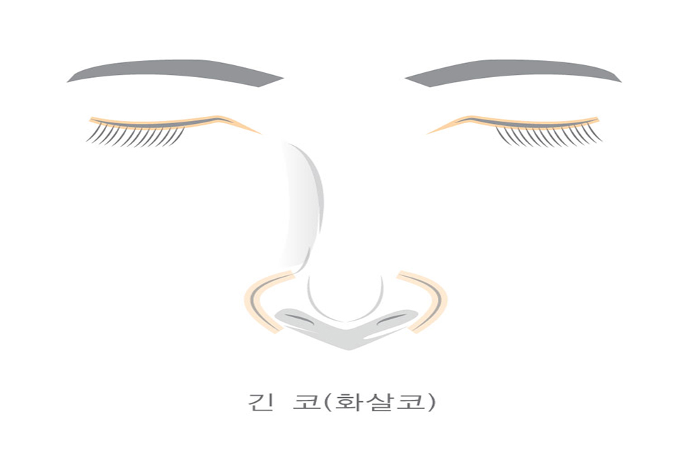 41gT59xXRP6kCaJc_20171205.jpg 처진코끝