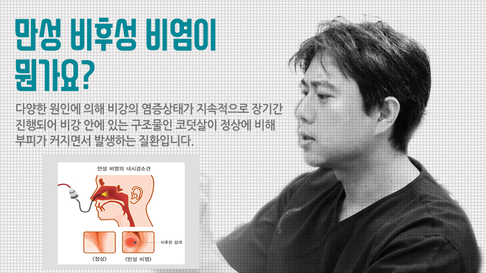 Ejf1GiPkbrQSMRhY_20180228.jpg 비염