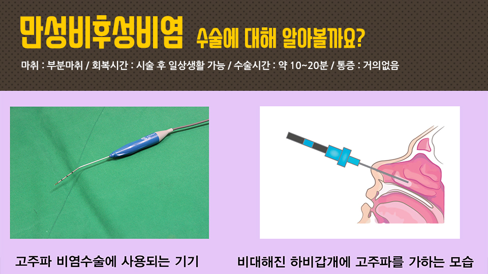 만성
 비염 치료