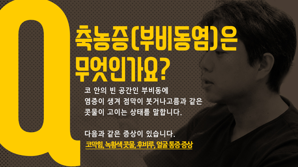 zNGIKjFpP3uABmVY_20180228.jpg 후비루