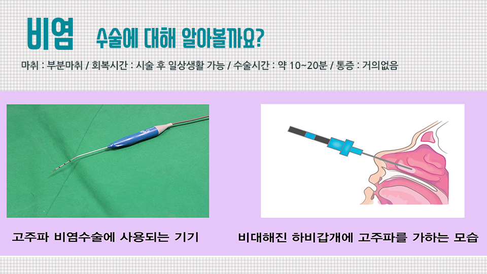 MbcEhxmlnao3p2Xz_20180306.jpg 비염수술입원