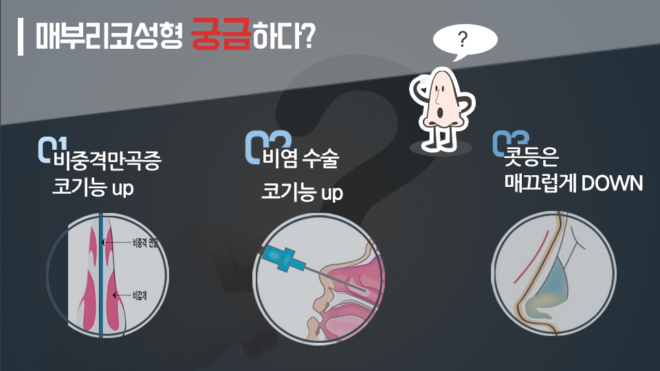 jNM9H7RtXKpzPBre_20180307.jpg 여자 매부리코
