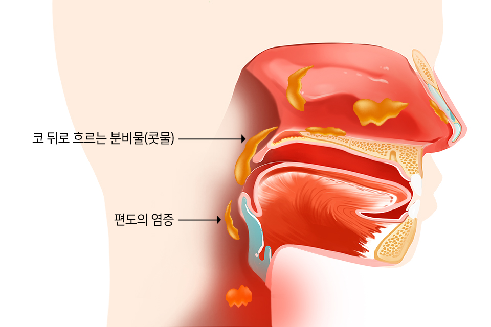 GI3MJ96VcrlthHXN_20180426.jpg