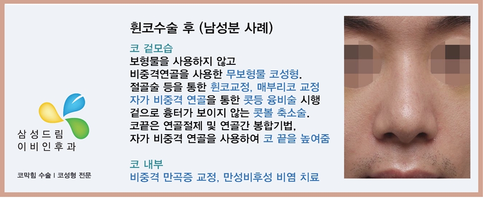 oZqXhP6wxQIYeERL_20180611.jpg