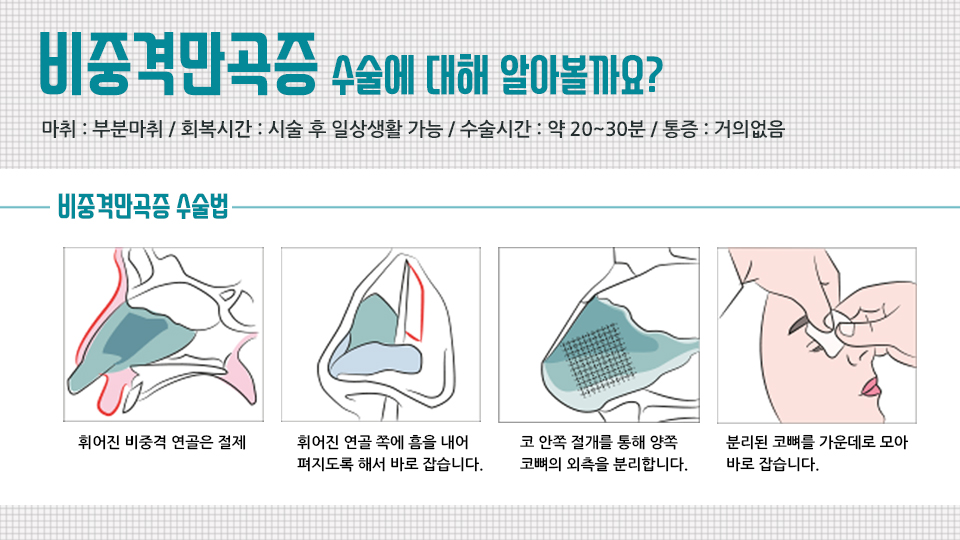 6foMiZJykqFTSuRv_20180702.jpg