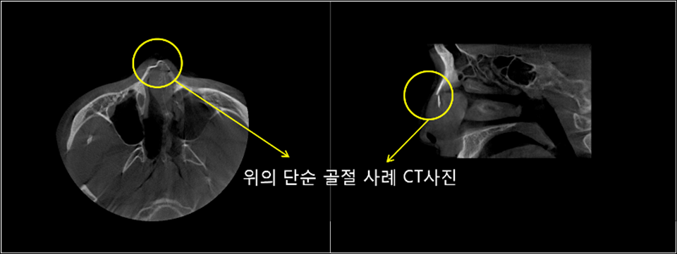 WX9Dm3d4fenRuMBh_20250228.png