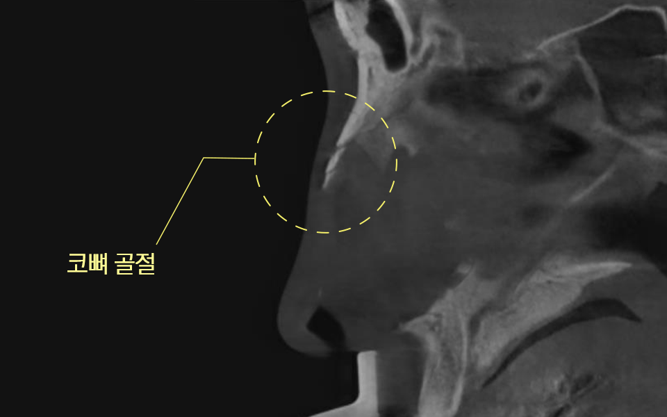 YbjX21367CiwuZQp_20250320.png