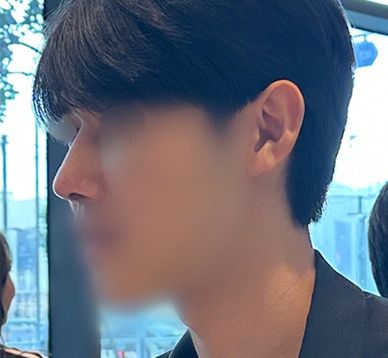 코막힘은 사라지고, 옆모습은 만족스럽게! 남자 기능코수술 후기