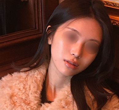 비염 때문에 힘들던 학업 생활, 수술 후 훨씬 편해졌어요!_여자기능코성형