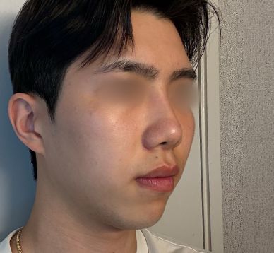 운동부 친구 추천으로 삼성드림 선택했습니다_남자기능코후기