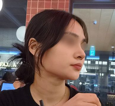 코막힘 스트레스 해결하고싶었습니다_여자기능코후기