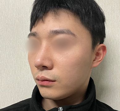 챗GPT와 몇 시간 동안의 대 회의 끝에 결정했습니다!_기능코수술후기