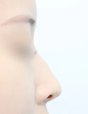  수술 전