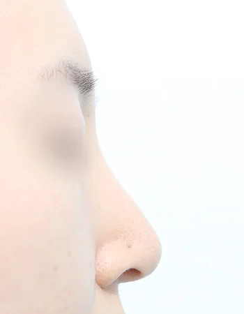  수술 전