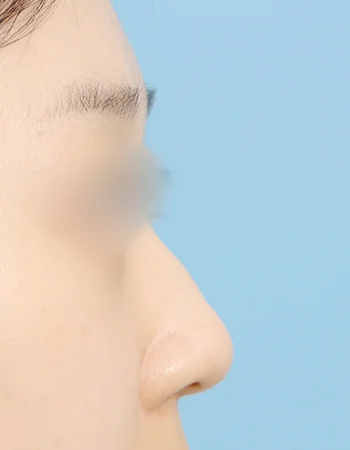  수술 전