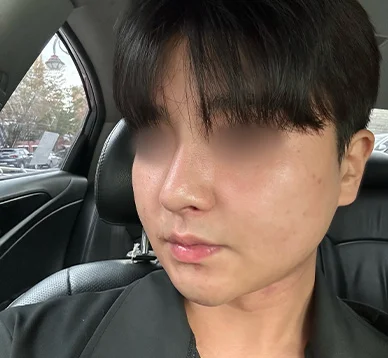 코로 숨 쉴 수 있어서 매일 아침이 개운합니다_남자기능코후기