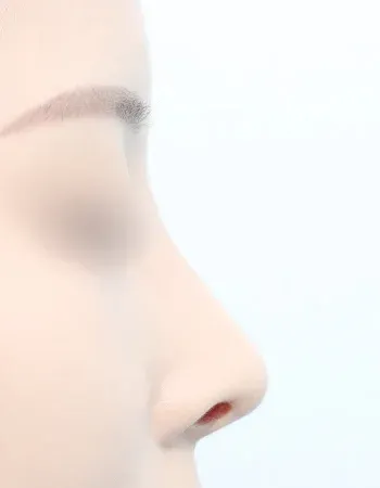  수술 후