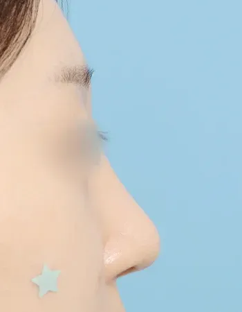  수술 후