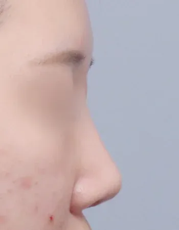  수술 후
