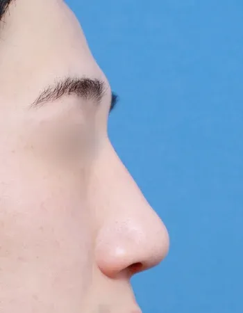  수술 후
