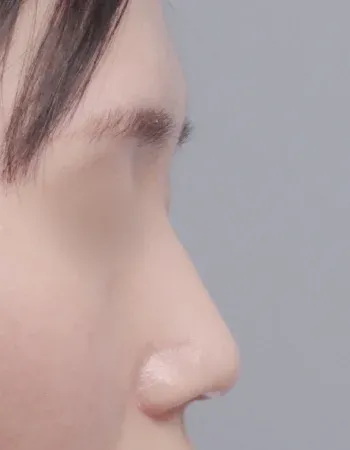  수술 후