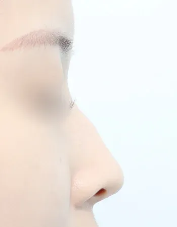  수술 전