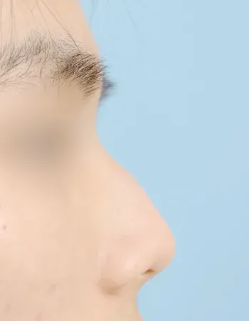  수술 전