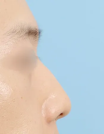  수술 전