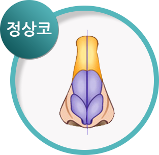 정상코 해부 이미지