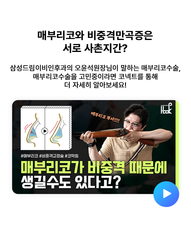 매부리코와 비중격만곡증은 서로 사촌지간?