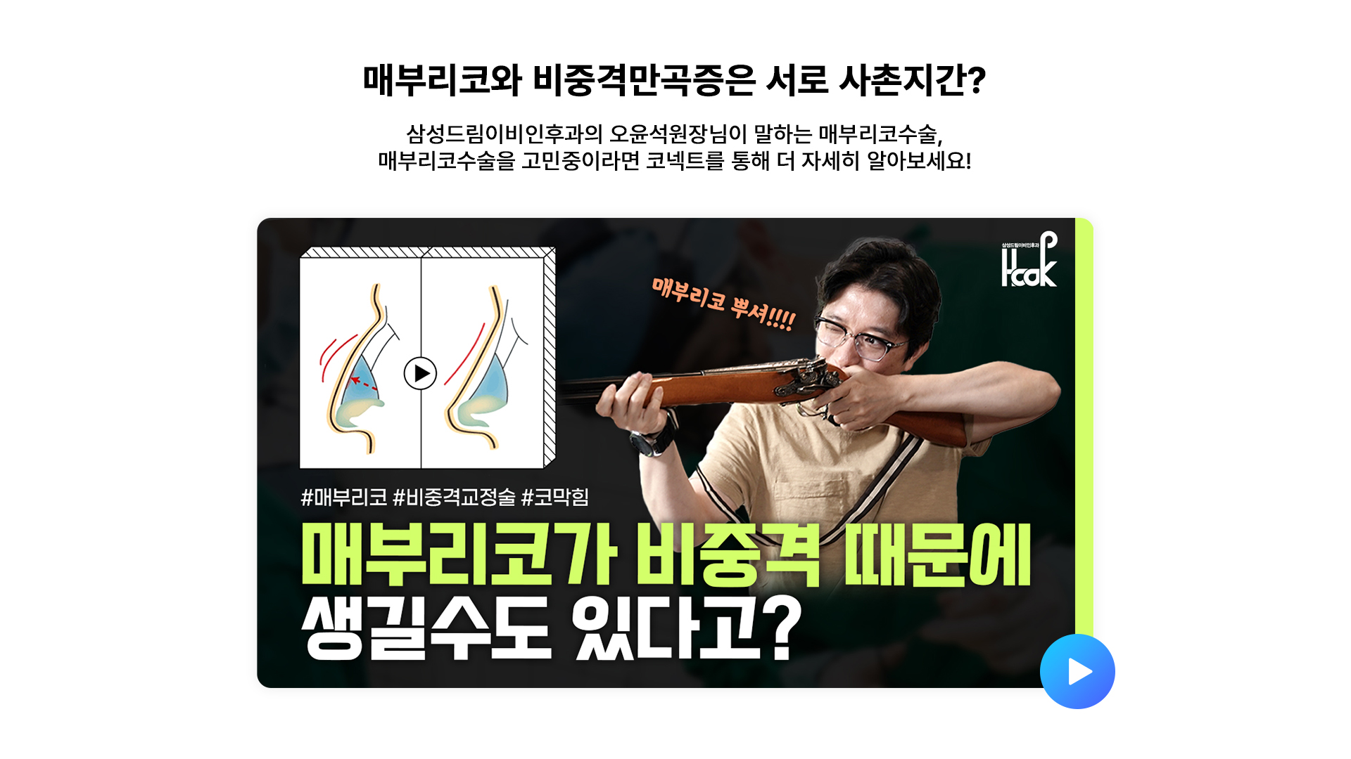 매부리코와 비중격만곡증은 서로 사촌지간?