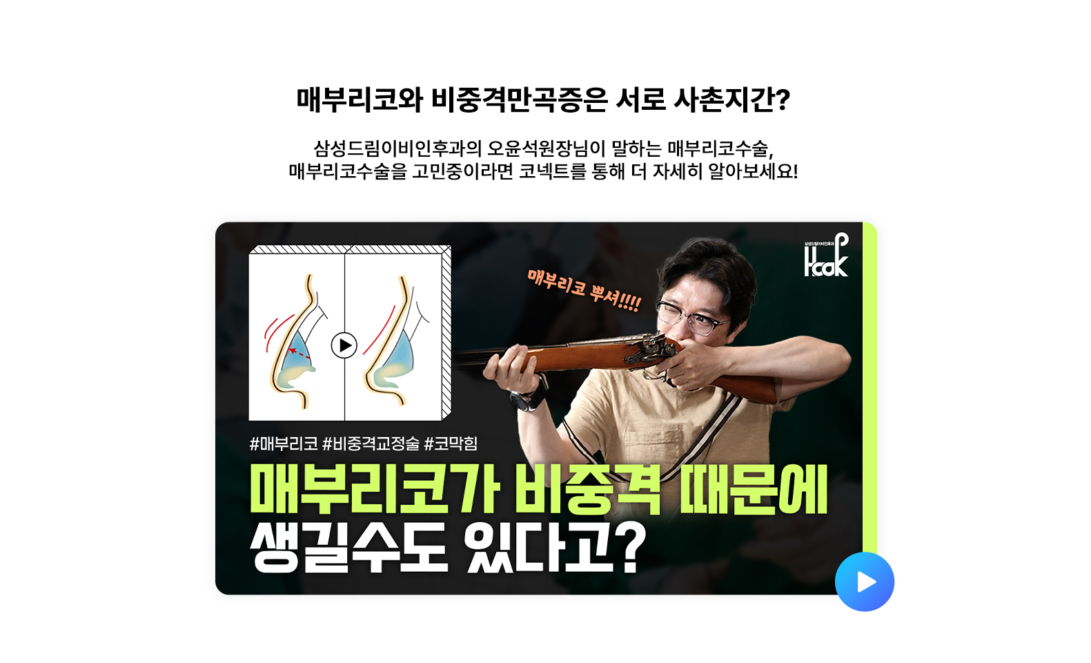 매부리코와 비중격만곡증은 서로 사촌지간?