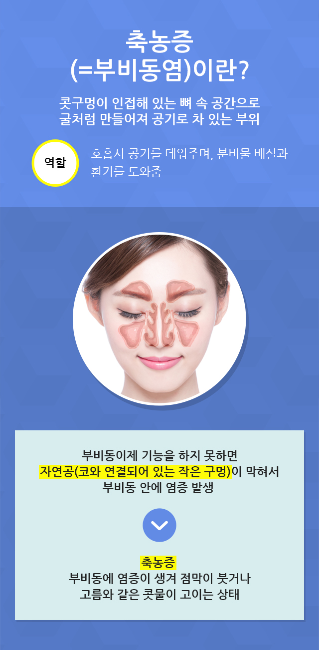 축농증수술 부비동염수술