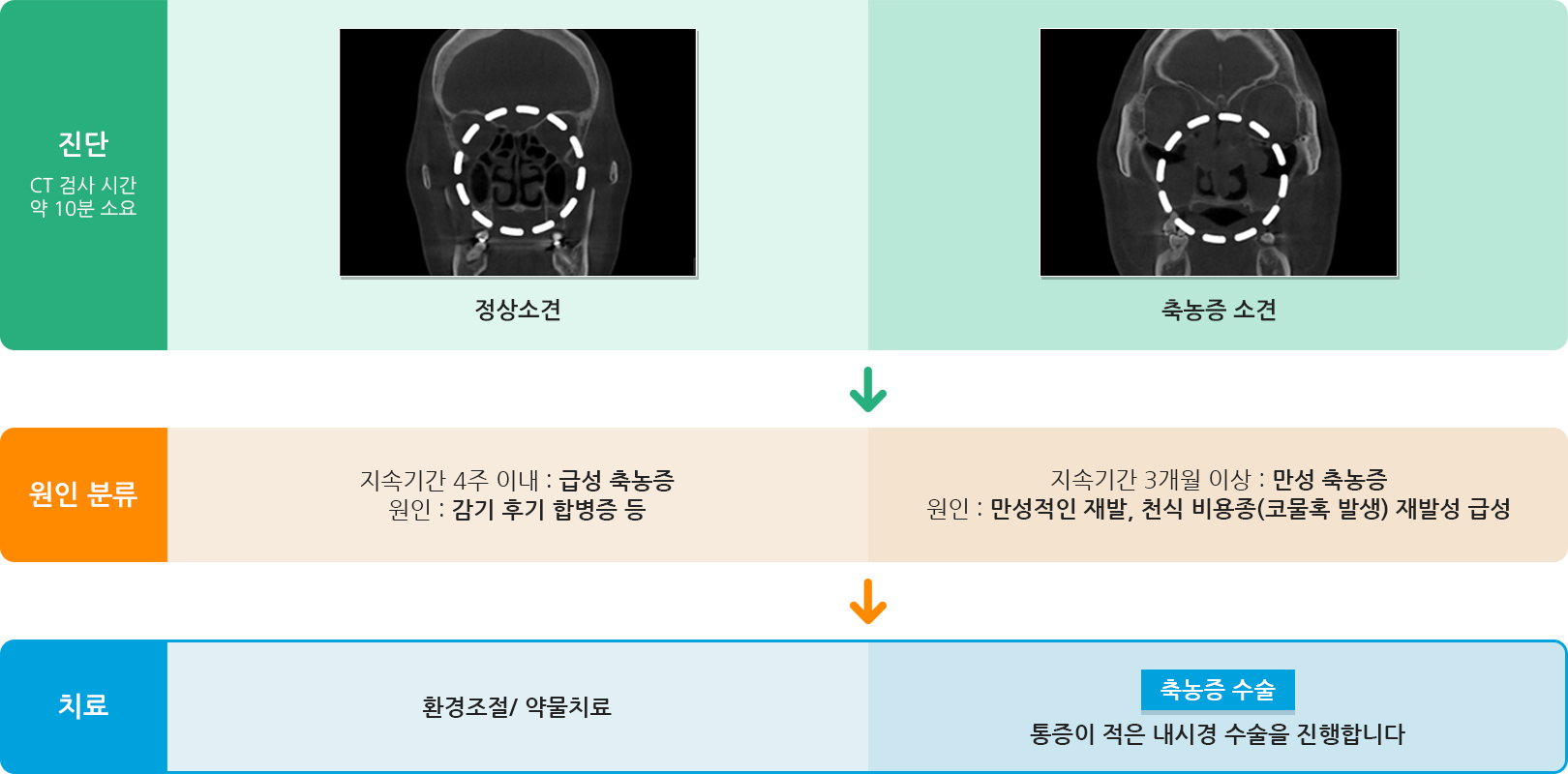 부비동염수술 진단