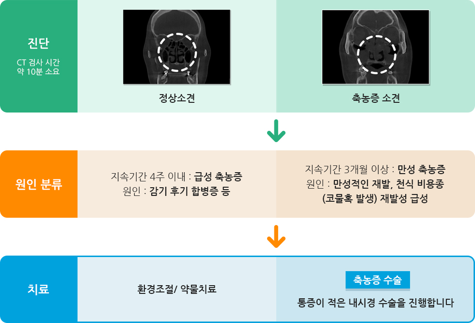 부비동염수술 진단