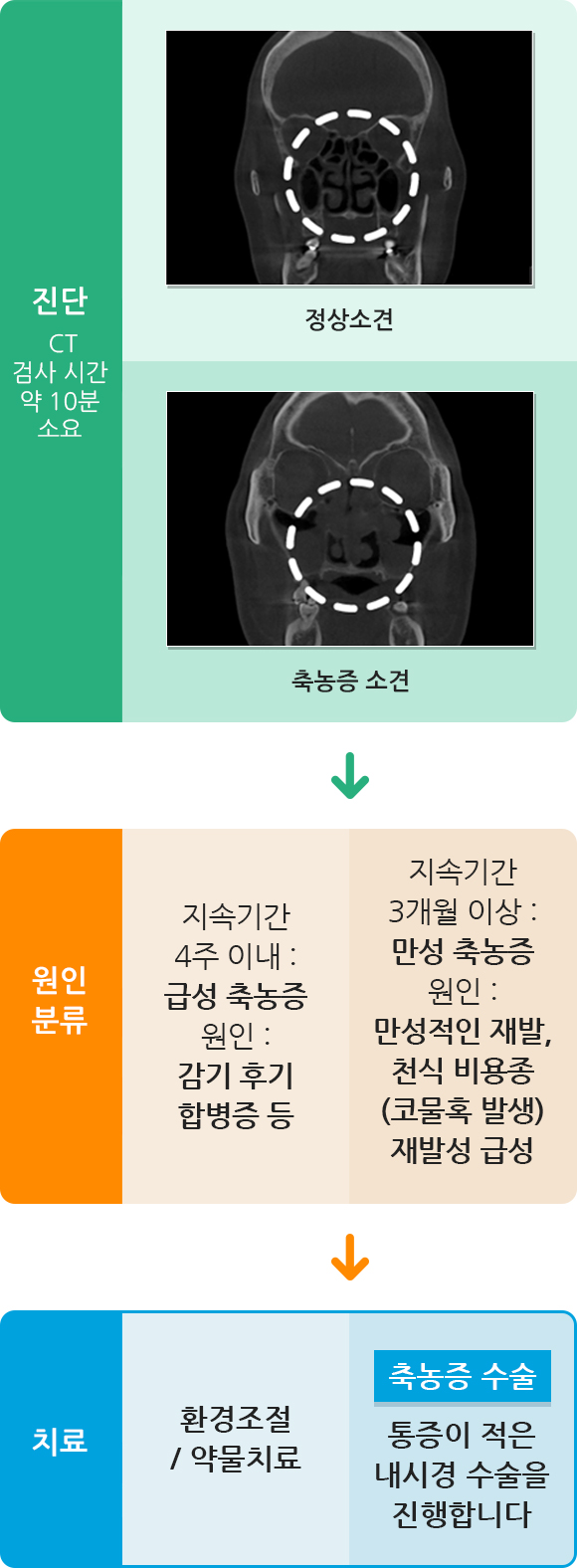 부비동염수술 진단