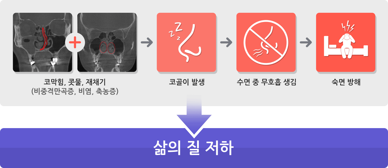 코막힘, 콧물, 재채기 (비중격만곡증, 비염, 축농증), 코골이 발생, 수면 중 무호흡 생김, 숙면 방해, 삶의 질 저하