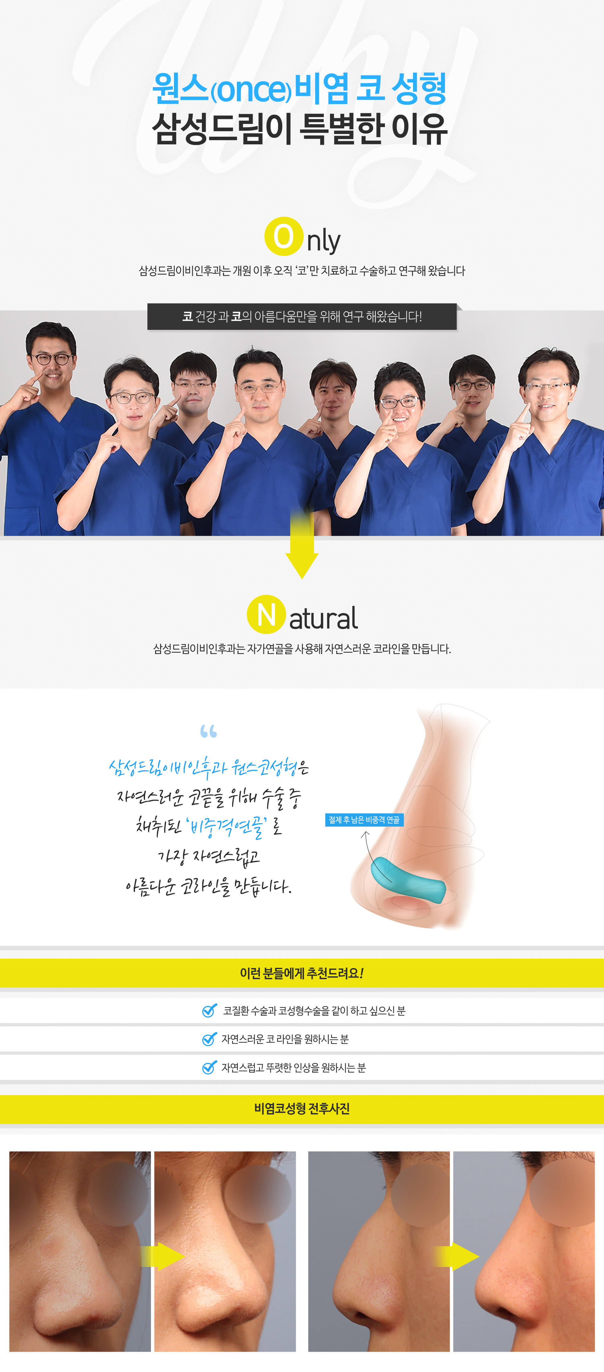 원스(ONCE)비염 코 성형 삼성드림이 특별한 이유 ONLY 삼성드림이비인후과는 개원 이후 오직 '코'만 치료하고 수술하고 연구해 왔습니다 코 건강과 코의 아름다움만을 위해 연구 해왔습니다! 환자분의 높은 만족도와 함께 현재까지 '100,000례 이상'의 코 수술을 진행해왔습니다 NATURAL 삼성드림이비인후과는 자가연골을 사용해 자연스러운 코라인을 만듭니다. 삼성드림이비인후과 원스코성형은 자연스러운 코끝을 위해 수술 중 채취된 '비중격연골'로 가장 자연스럽고 아름다운 코라인을 만듭니다. 절제 후 남은 비중격 연골 이런 분들에게 추천드려요! 코질환 수술과 코성형수술을 같이 하고 싶으신 분, 자연스러운 코 라인을 원하시는 분, 자연스럽고 뚜렷한 인상을 원하시는 분 비염코성형 전후사진