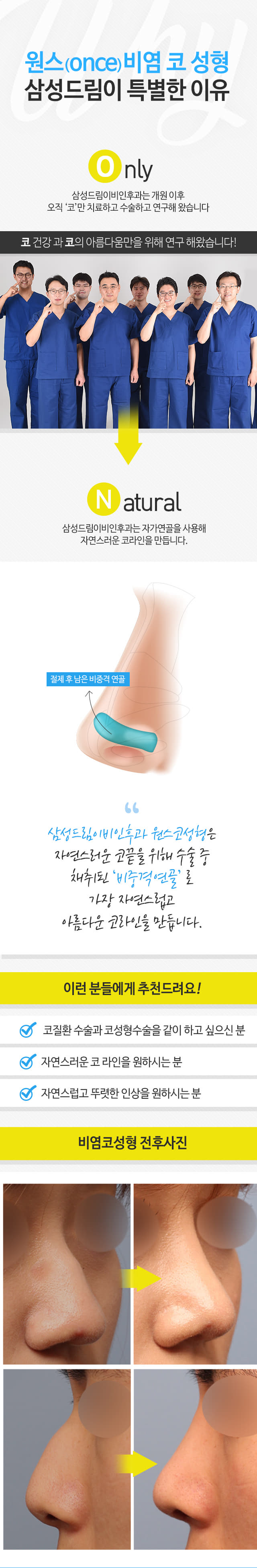 원스(ONCE)비염 코 성형 삼성드림이 특별한 이유 ONLY 삼성드림이비인후과는 개원 이후 오직 '코'만 치료하고 수술하고 연구해 왔습니다 코 건강과 코의 아름다움만을 위해 연구 해왔습니다! 환자분의 높은 만족도와 함께 현재까지 '100,000례 이상'의 코 수술을 진행해왔습니다 NATURAL 삼성드림이비인후과는 자가연골을 사용해 자연스러운 코라인을 만듭니다. 삼성드림이비인후과 원스코성형은 자연스러운 코끝을 위해 수술 중 채취된 '비중격연골'로 가장 자연스럽고 아름다운 코라인을 만듭니다. 절제 후 남은 비중격 연골 이런 분들에게 추천드려요! 코질환 수술과 코성형수술을 같이 하고 싶으신 분, 자연스러운 코 라인을 원하시는 분, 자연스럽고 뚜렷한 인상을 원하시는 분 비염코성형 전후사진