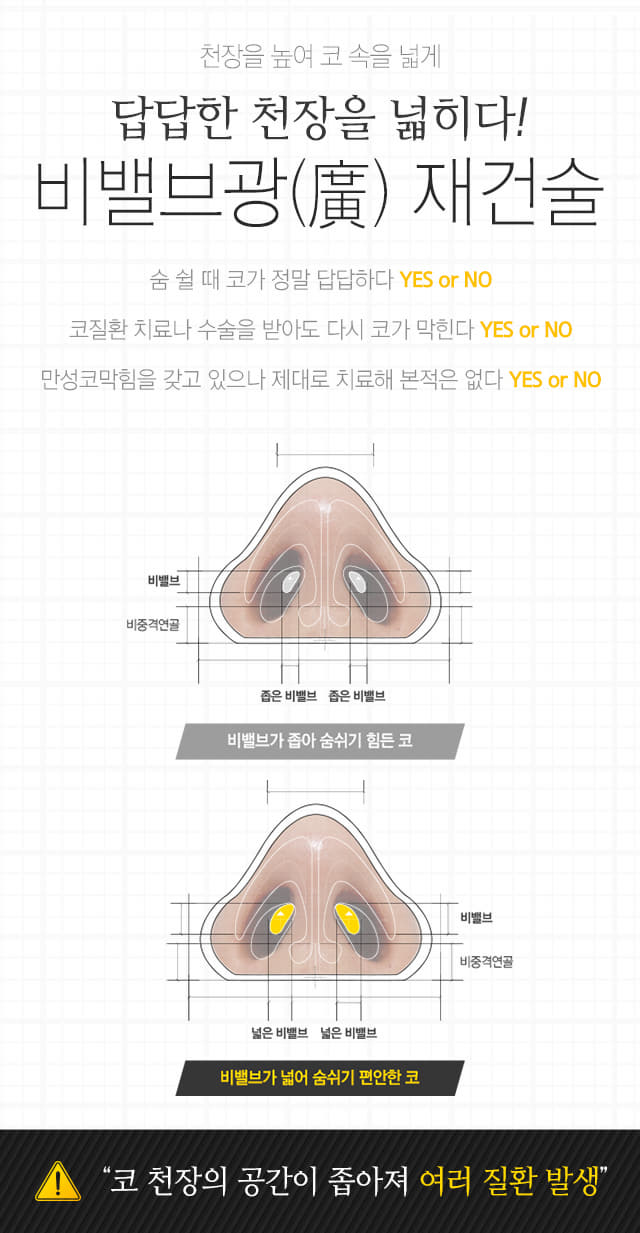 비밸브 재건 수술