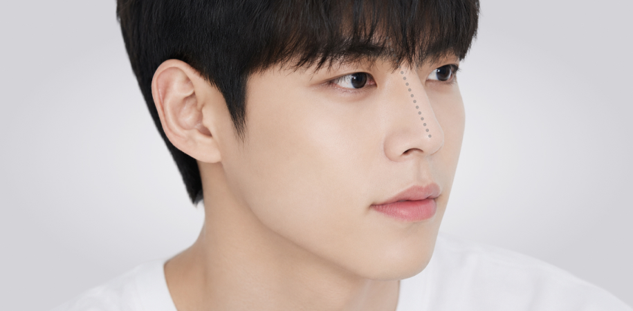 남자 코성형의 직선 코 라인을 보여주는 남성 옆모습