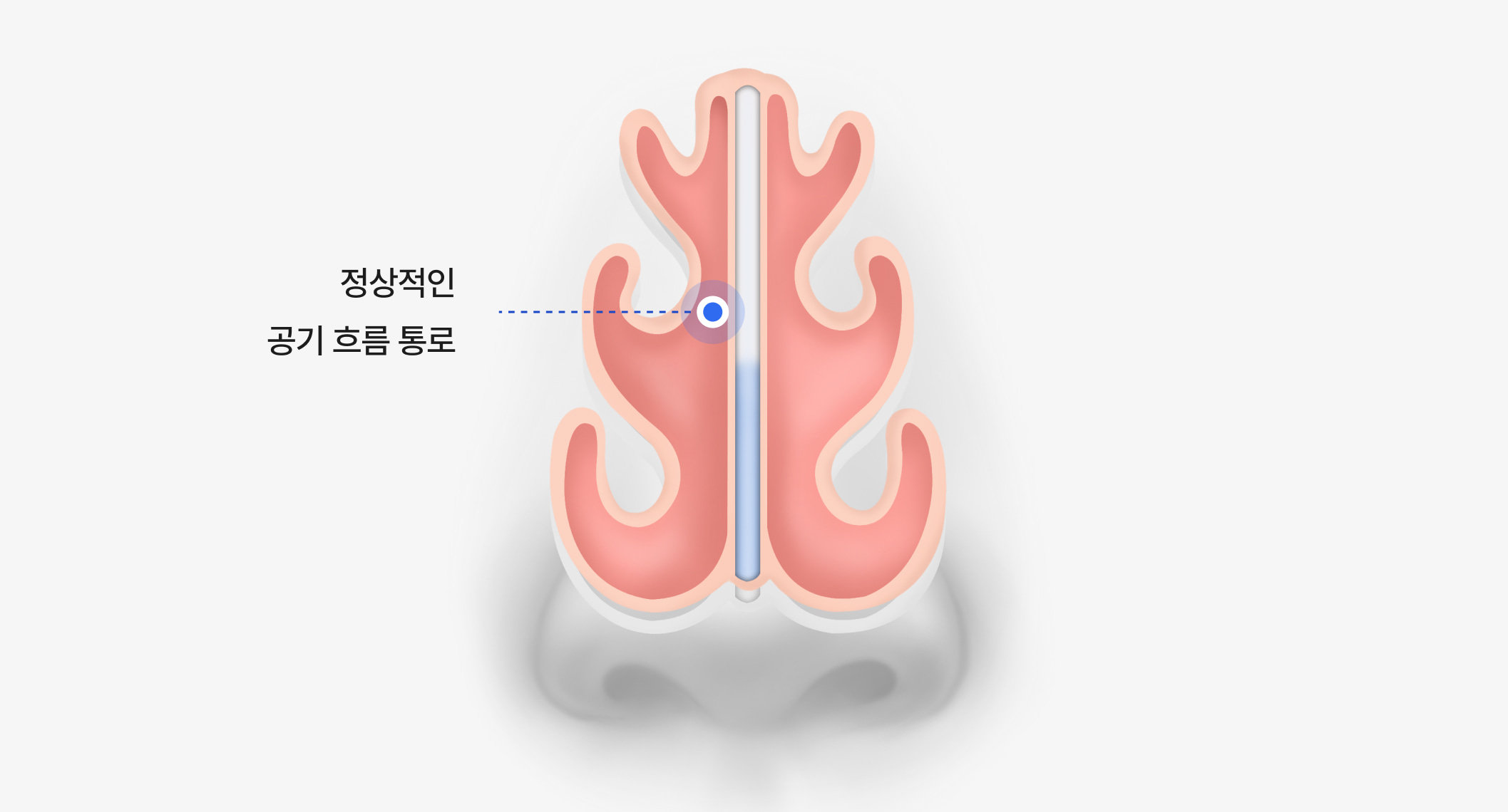 정상 비중격과 원활한 공기 흐름을 보여주는 비강 구조 일러스트