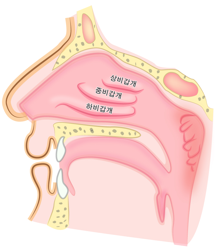 비중격만곡증 수술