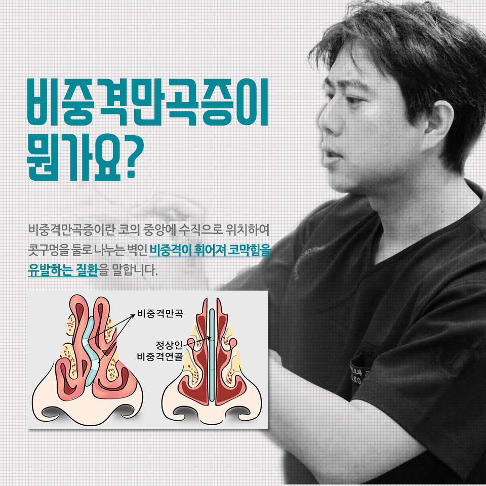 비중격코수술