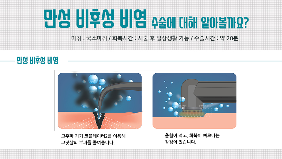 만성비염