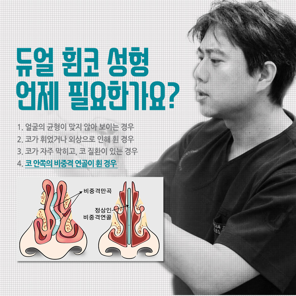 휜코 성형