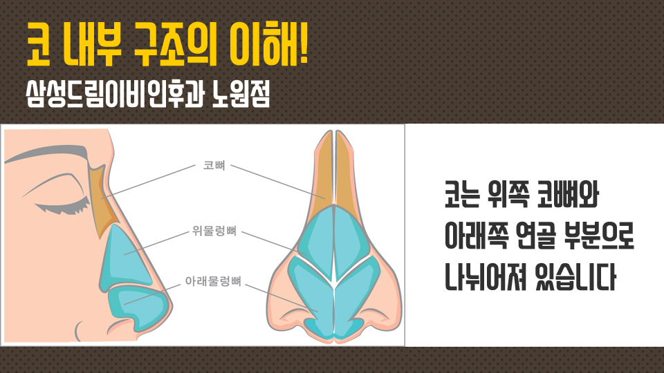 매부리코수술붓기